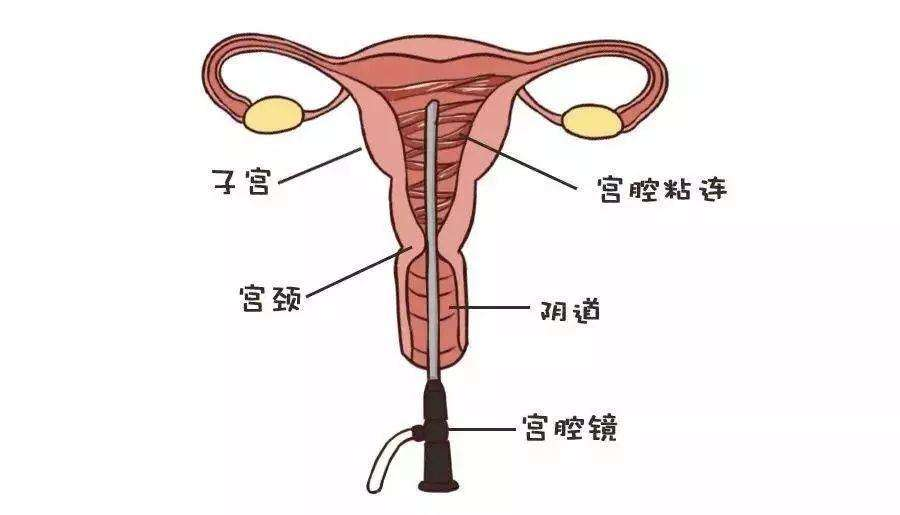 泰国第三代试管婴儿