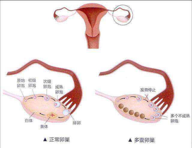 泰国第三代试管婴儿