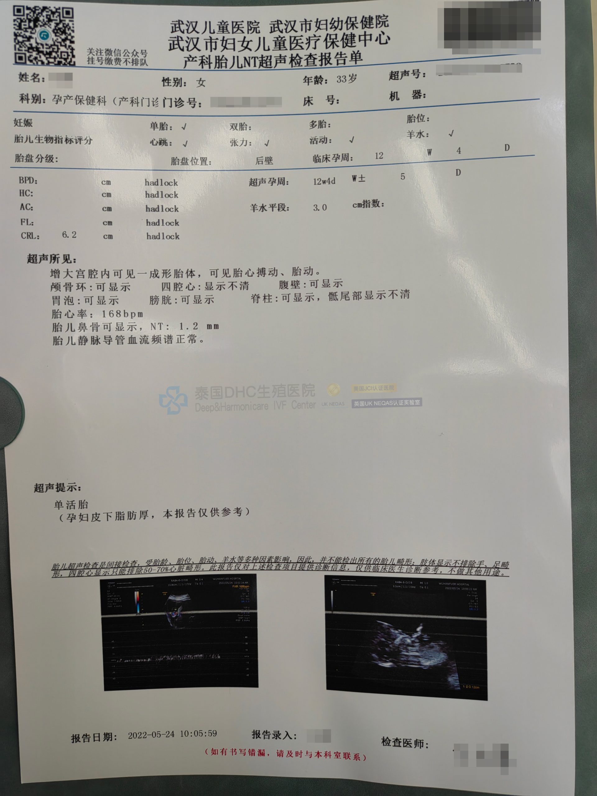 泰国第三代试管婴儿