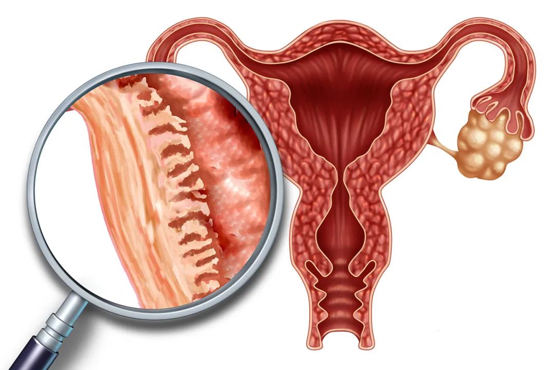 泰国第三代试管婴儿