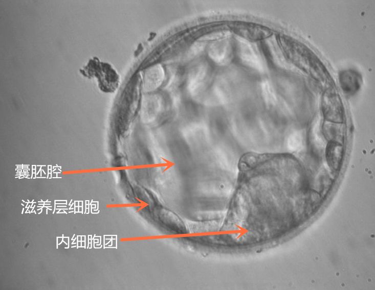 泰国第三代试管婴儿