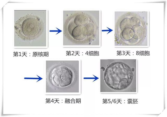 泰国第三代试管婴儿